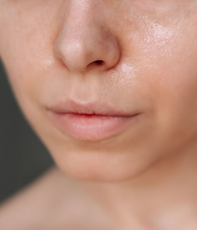 Understanding and Managing Skin Redness