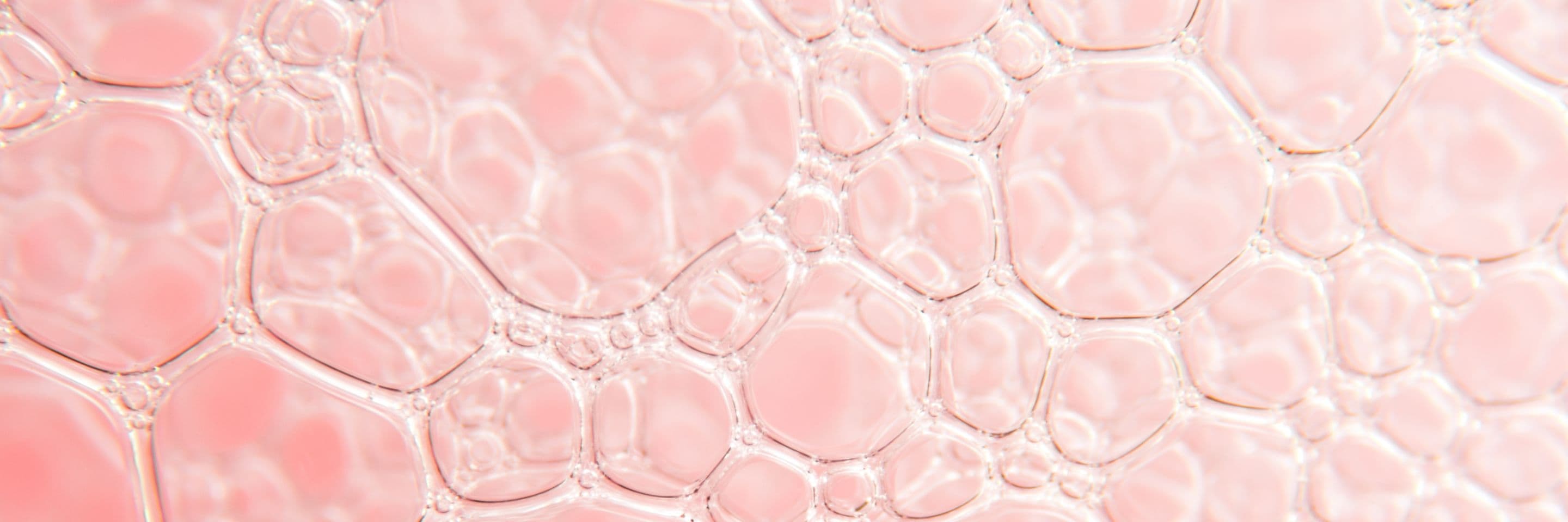 Rosacea Relief: Expert Tips for Managing Redness and Inflammation